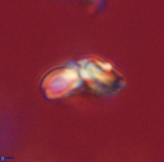 Cyclagelosphaera elevatocycla 62359
