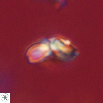 Cyclagelosphaera elevatocycla 62359