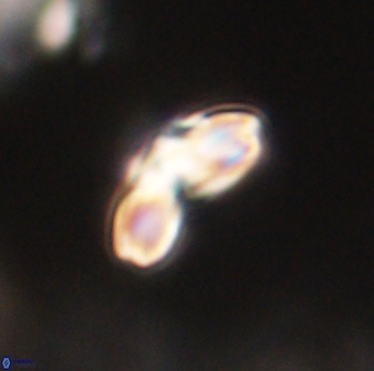 Cyclagelosphaera elevatocycla 62361