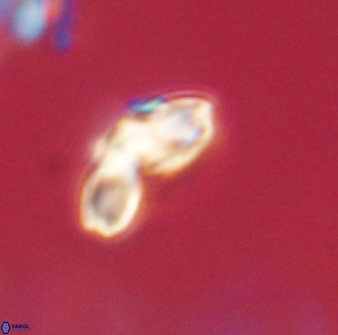 Cyclagelosphaera elevatocycla 62362