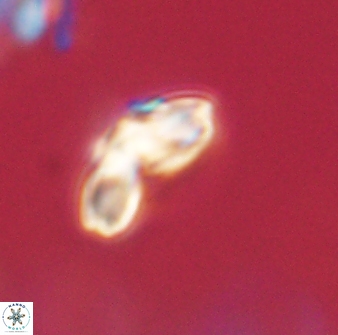 Cyclagelosphaera elevatocycla 62362