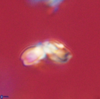 Cyclagelosphaera elevatocycla 62363