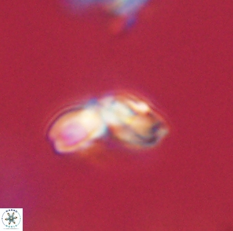 Cyclagelosphaera elevatocycla 62363