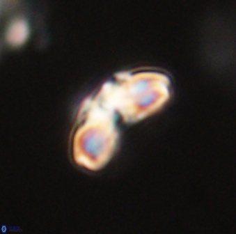 Cyclagelosphaera elevatocycla 62365