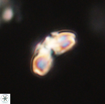 Cyclagelosphaera elevatocycla 62365