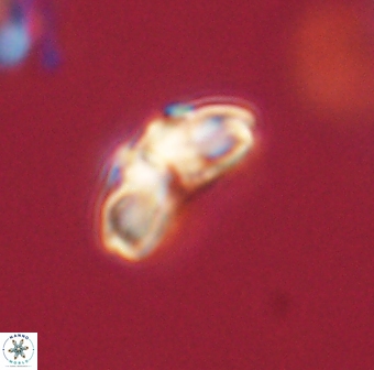 Cyclagelosphaera elevatocycla 62366