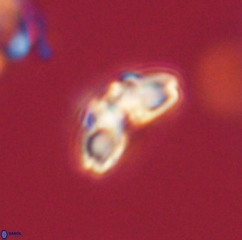 Cyclagelosphaera elevatocycla 62367