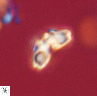 Cyclagelosphaera elevatocycla 62367