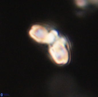 Cyclagelosphaera elevatocycla 62369