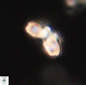 Cyclagelosphaera elevatocycla 62369