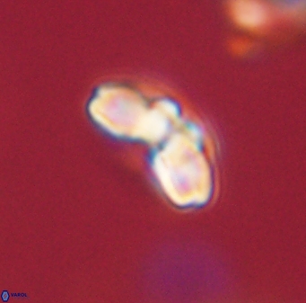 Cyclagelosphaera elevatocycla 62370