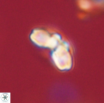 Cyclagelosphaera elevatocycla 62370
