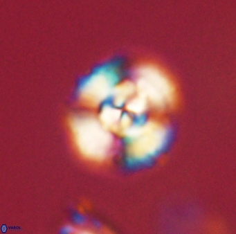 Cyclagelosphaera elevatocycla 62382