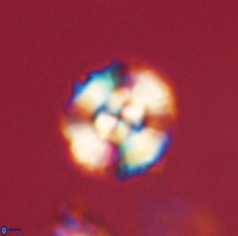 Cyclagelosphaera elevatocycla 62384
