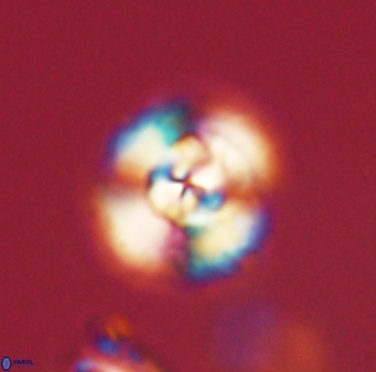 Cyclagelosphaera elevatocycla 62385