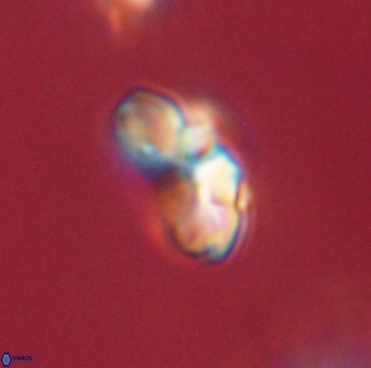 Cyclagelosphaera elevatocycla 62387