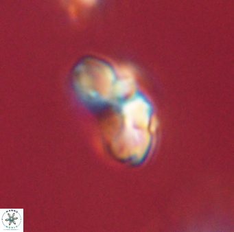 Cyclagelosphaera elevatocycla 62387