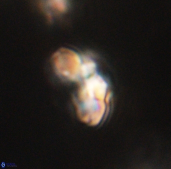 Cyclagelosphaera elevatocycla 62389