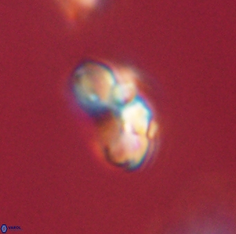 Cyclagelosphaera elevatocycla 62390