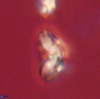 Cyclagelosphaera elevatocycla 62391