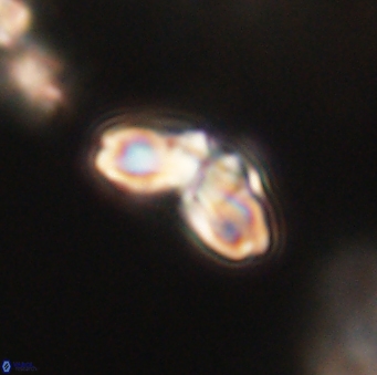 Cyclagelosphaera elevatocycla 62393