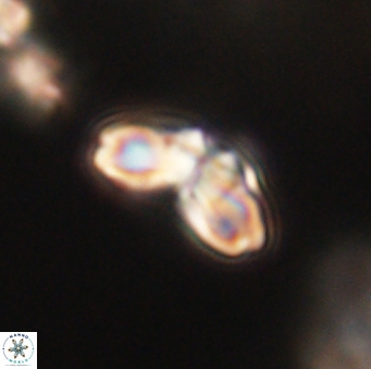 Cyclagelosphaera elevatocycla 62393