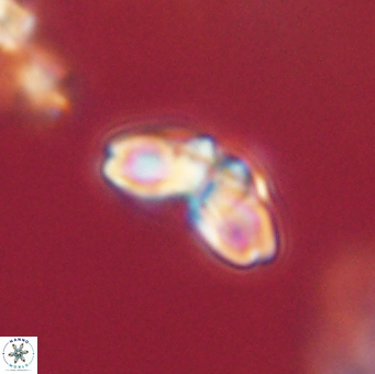 Cyclagelosphaera elevatocycla 62394