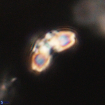 Cyclagelosphaera elevatocycla 62397