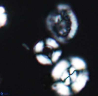 Cyclagelosphaera jiangii 11630