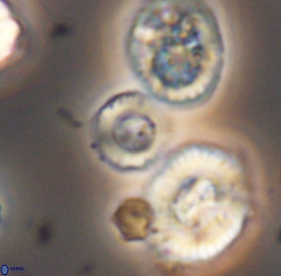 Cyclagelosphaera jiangii 11631