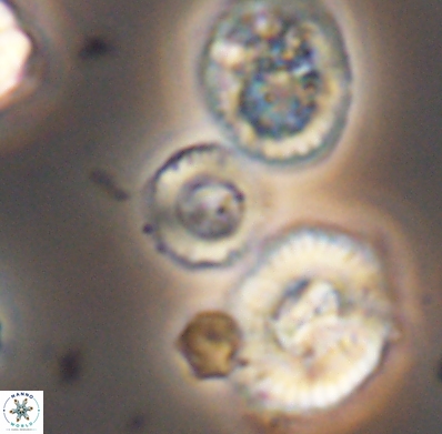 Cyclagelosphaera jiangii 11631