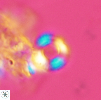 Cyclagelosphaera jiangii 3513