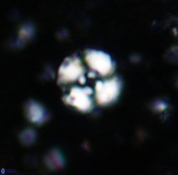 Cyclagelosphaera lacuna 1587