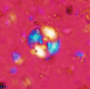 Cyclagelosphaera lacuna 1588