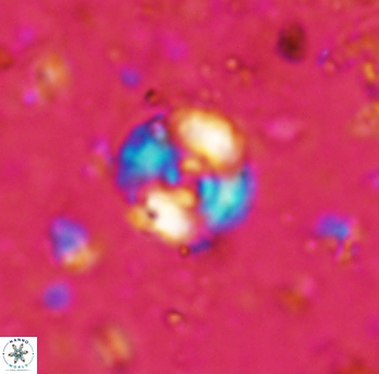 Cyclagelosphaera lacuna 1588