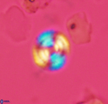 Cyclagelosphaera laticycla 2945