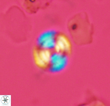 Cyclagelosphaera laticycla 2945