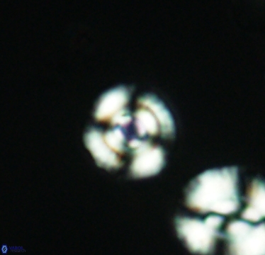 Cyclagelosphaera laticycla 2940