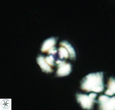 Cyclagelosphaera laticycla 2940