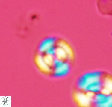 Cyclagelosphaera laticycla 2941