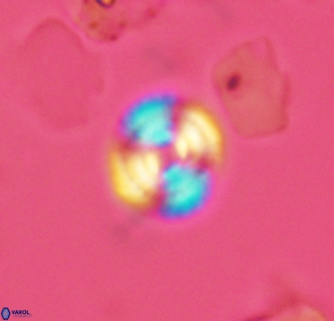 Cyclagelosphaera laticycla 2943