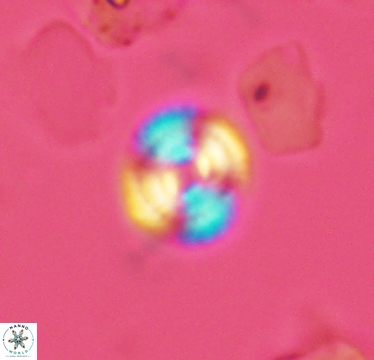 Cyclagelosphaera laticycla 2943