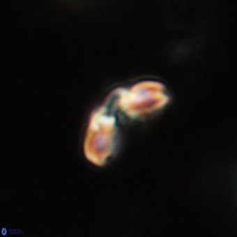 Cyclagelosphaera paez rayesii 67295