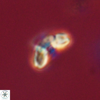 Cyclagelosphaera paez rayesii 67297
