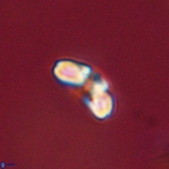 Cyclagelosphaera paez rayesii 67305