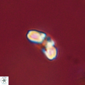 Cyclagelosphaera paez rayesii 67305