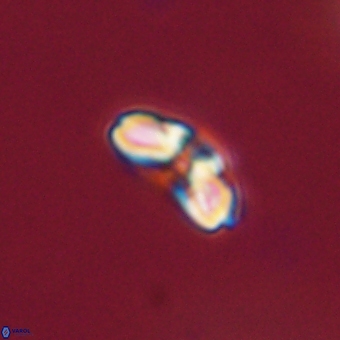 Cyclagelosphaera paez rayesii 67308