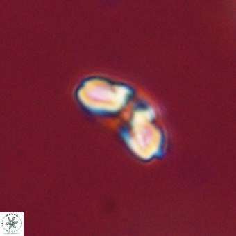 Cyclagelosphaera paez rayesii 67308