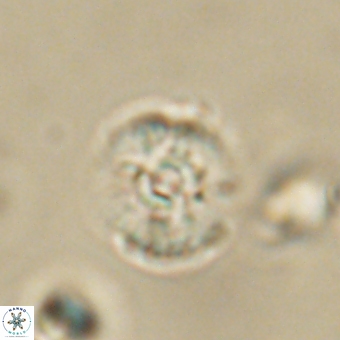 Cyclagelosphaera paez rayesii 67317