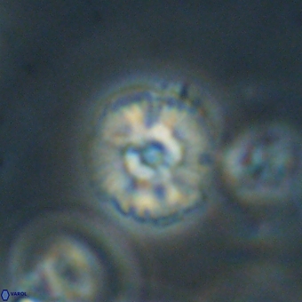 Cyclagelosphaera paez rayesii 67318